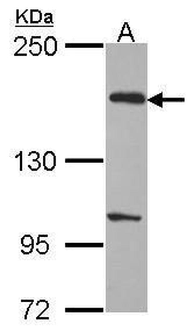 EVC2 Antibody in Western Blot (WB)