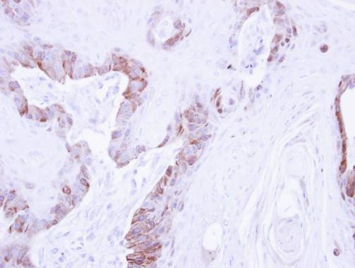 LIMK2 Antibody in Immunohistochemistry (Paraffin) (IHC (P))