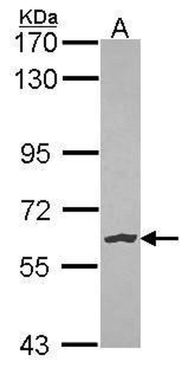 NLK Antibody in Western Blot (WB)