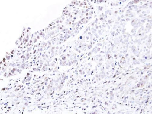 NUP62 Antibody in Immunohistochemistry (Paraffin) (IHC (P))