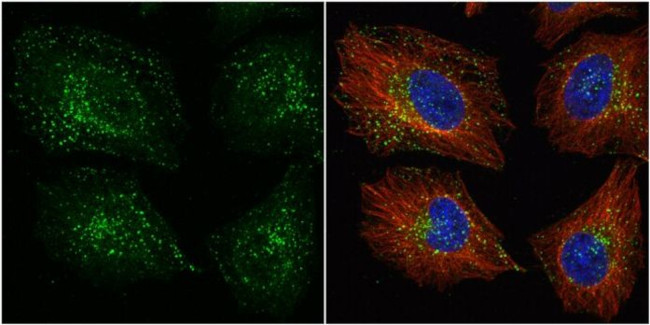 VPS35 Antibody in Immunocytochemistry (ICC/IF)