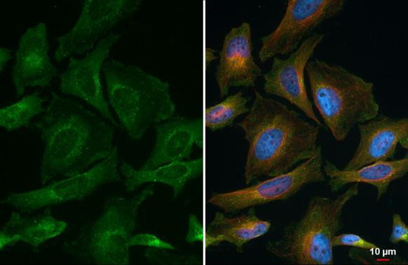 VPS35 Antibody in Immunocytochemistry (ICC/IF)