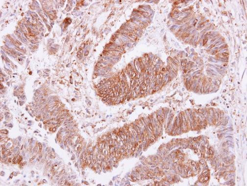 VPS35 Antibody in Immunohistochemistry (Paraffin) (IHC (P))