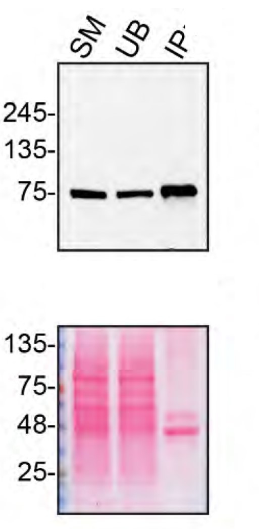 VPS35 Antibody in Immunoprecipitation (IP)