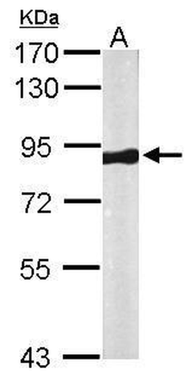 VPS35 Antibody in Western Blot (WB)