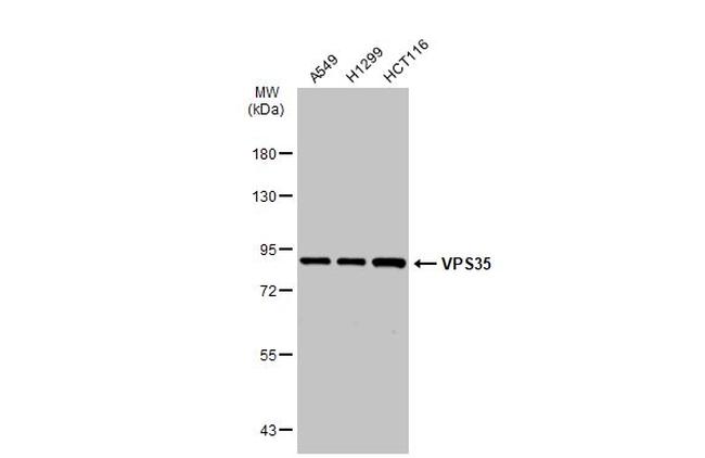 VPS35 Antibody in Western Blot (WB)