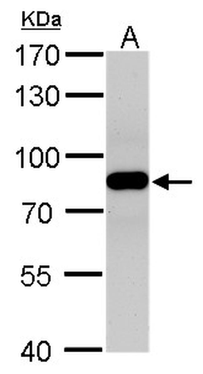 VPS35 Antibody in Western Blot (WB)