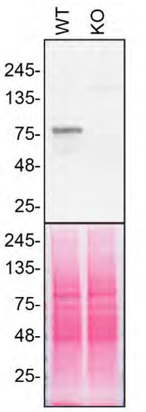 VPS35 Antibody in Western Blot (WB)