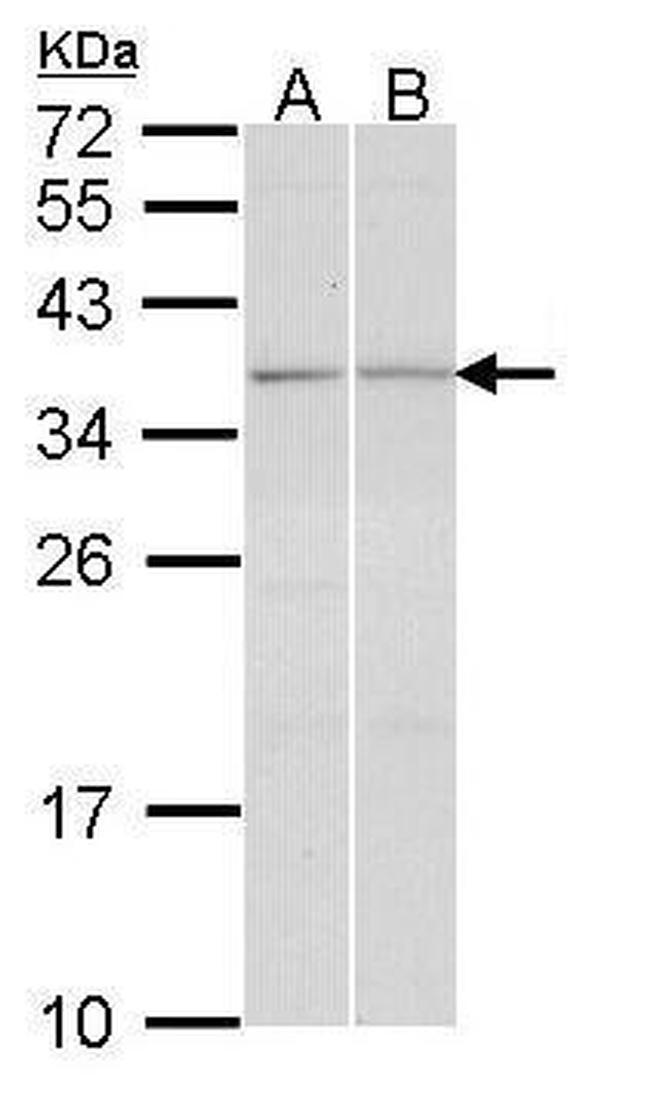 TGIF2 Antibody in Western Blot (WB)