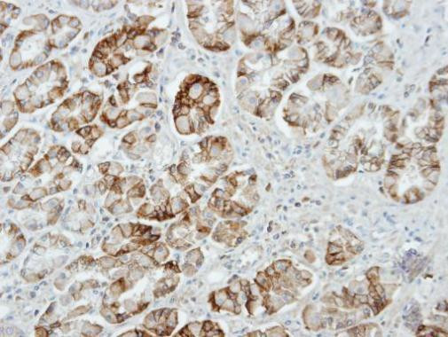 Munc13-4 Antibody in Immunohistochemistry (Paraffin) (IHC (P))