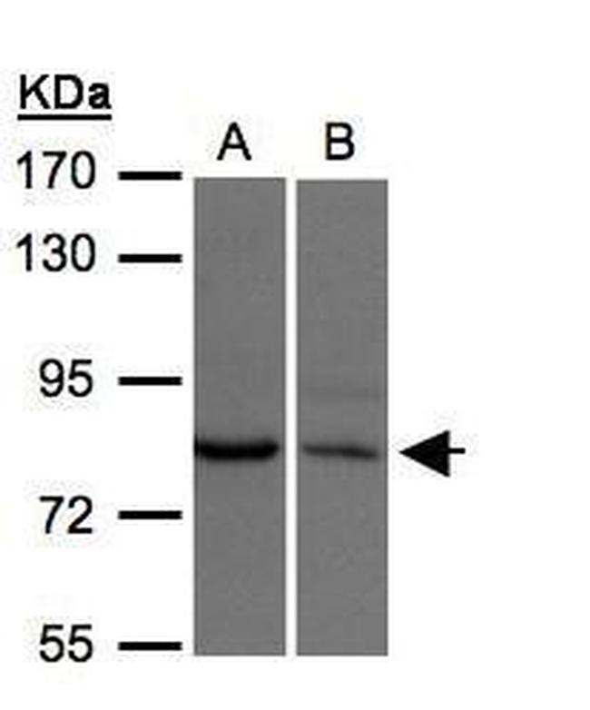 XPR1 Antibody in Western Blot (WB)