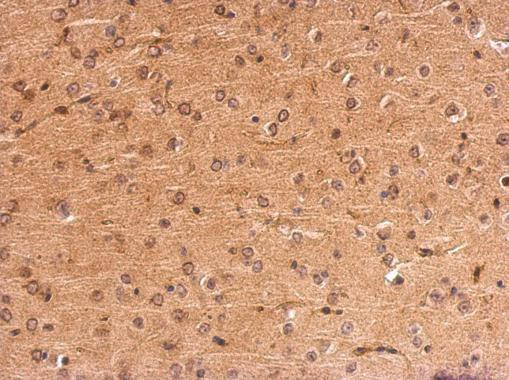 MC1R Antibody in Immunohistochemistry (Paraffin) (IHC (P))