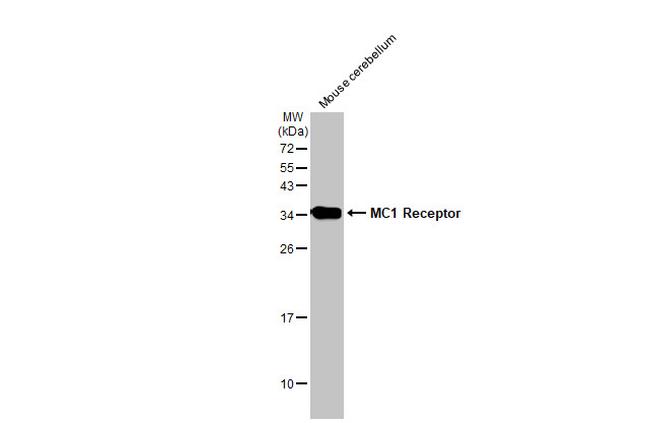 MC1R Antibody in Western Blot (WB)