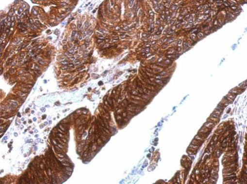 Thrombomodulin Antibody in Immunohistochemistry (Paraffin) (IHC (P))