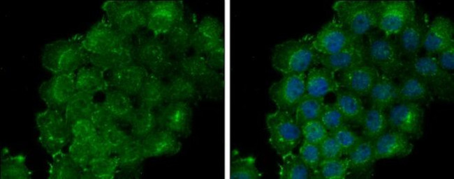 Thrombomodulin Antibody in Immunocytochemistry (ICC/IF)