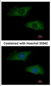 Interferon alpha-2 Antibody in Immunocytochemistry (ICC/IF)