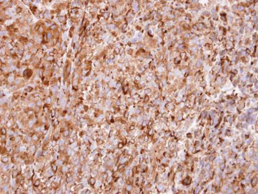 Interferon alpha-2 Antibody in Immunohistochemistry (Paraffin) (IHC (P))