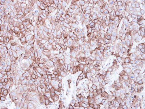 Caveolin 2 Antibody in Immunohistochemistry (Paraffin) (IHC (P))