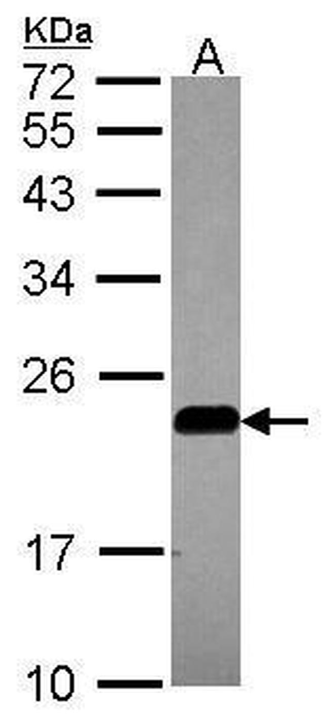 Caveolin 2 Antibody in Western Blot (WB)