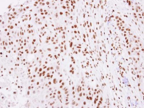 Histone H2A.Z Antibody in Immunohistochemistry (Paraffin) (IHC (P))