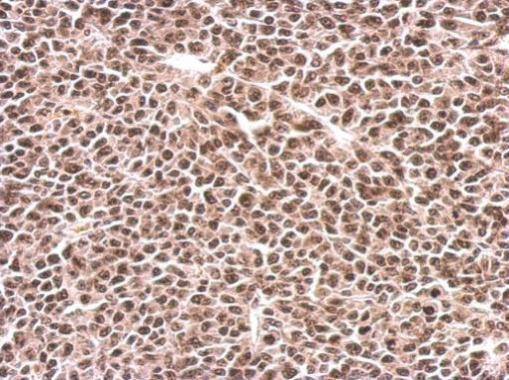 PFKFB3 Antibody in Immunohistochemistry (Paraffin) (IHC (P))