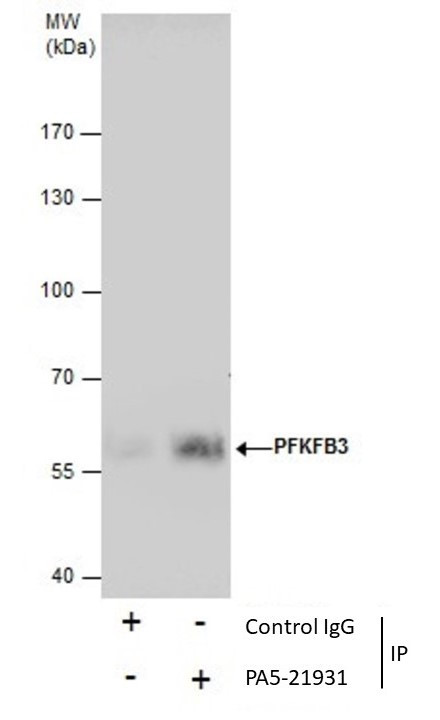 PFKFB3 Antibody in Immunoprecipitation (IP)