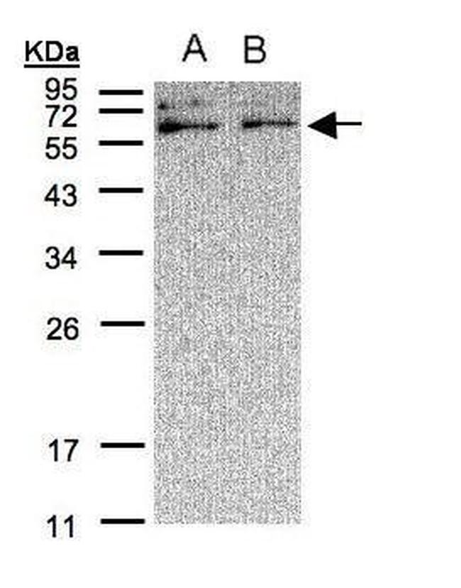 XYLB Antibody in Western Blot (WB)