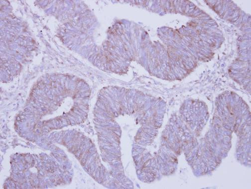 PHKA2 Antibody in Immunohistochemistry (Paraffin) (IHC (P))