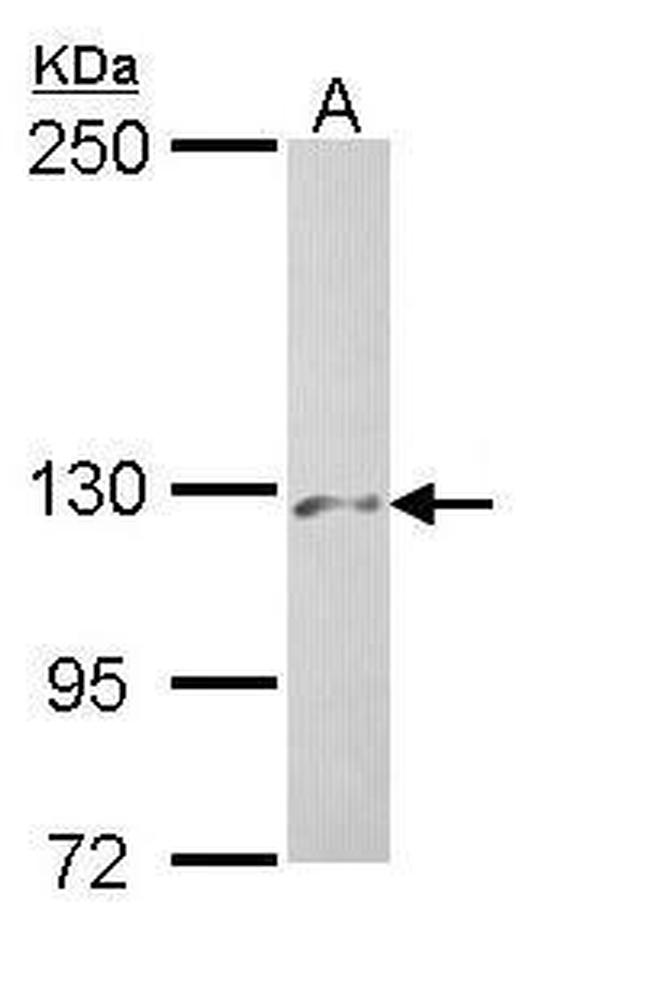 PHKA2 Antibody in Western Blot (WB)