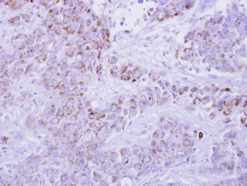 CCL1 Antibody in Immunohistochemistry (Paraffin) (IHC (P))