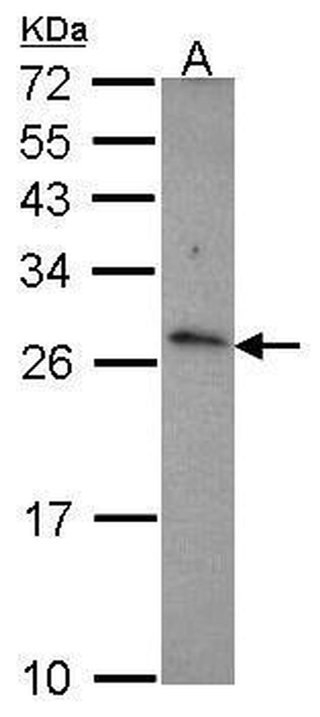 CD70 Antibody in Western Blot (WB)