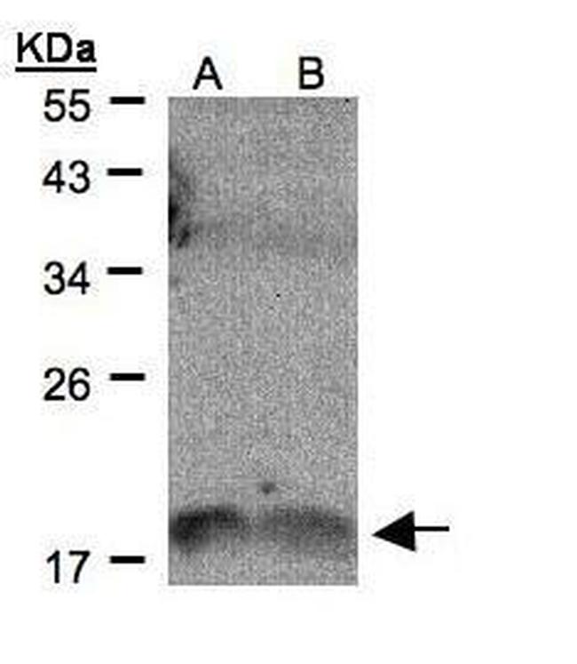 IL1F9 Antibody in Western Blot (WB)