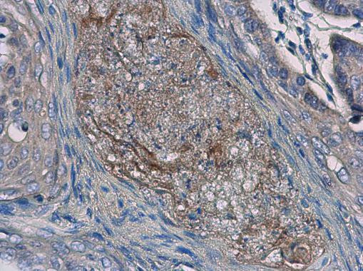 IL24 Antibody in Immunohistochemistry (Paraffin) (IHC (P))