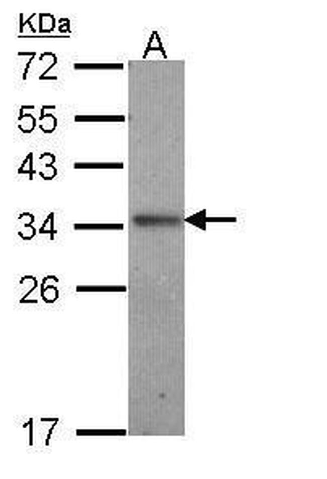 IL24 Antibody in Western Blot (WB)