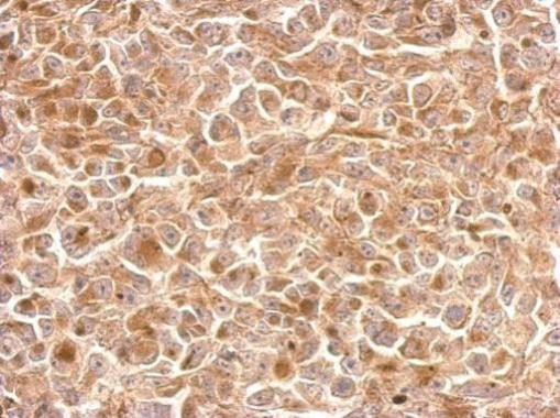 NKG2A Antibody in Immunohistochemistry (Paraffin) (IHC (P))