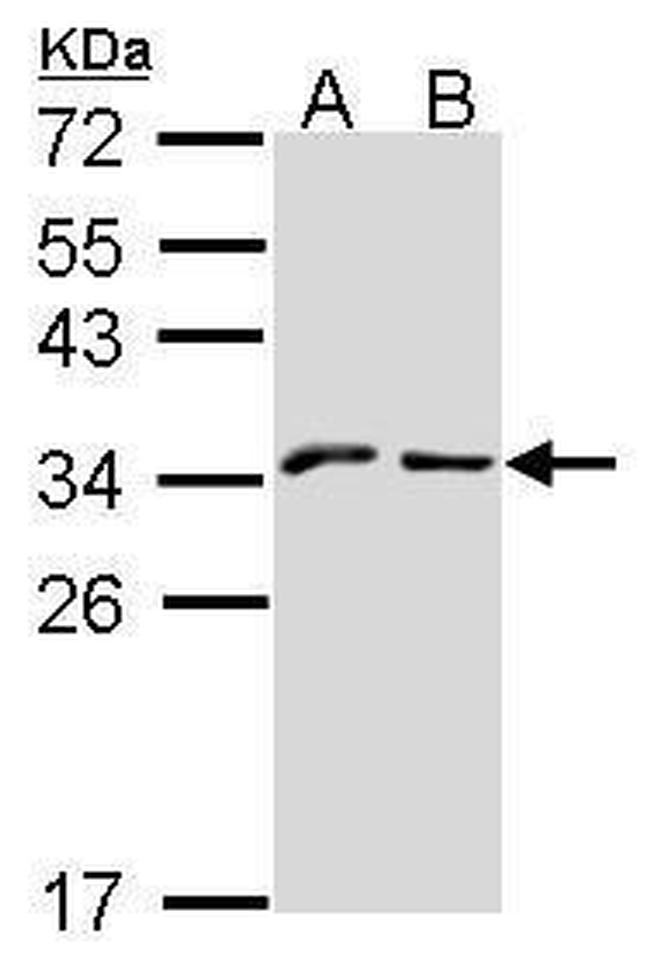 NKG2A Antibody in Western Blot (WB)