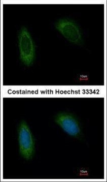 TRAM1 Antibody in Immunocytochemistry (ICC/IF)