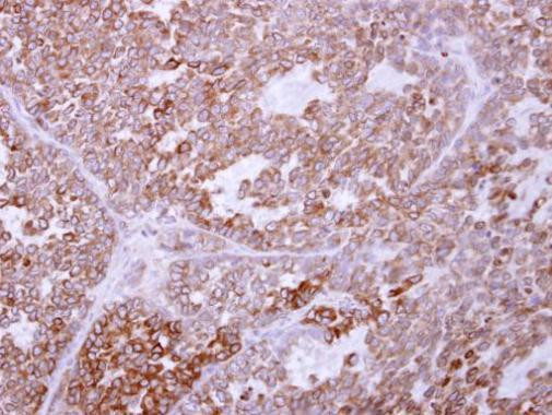 TRAM1 Antibody in Immunohistochemistry (Paraffin) (IHC (P))