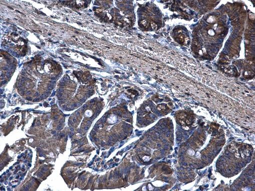 TRAM1 Antibody in Immunohistochemistry (Paraffin) (IHC (P))