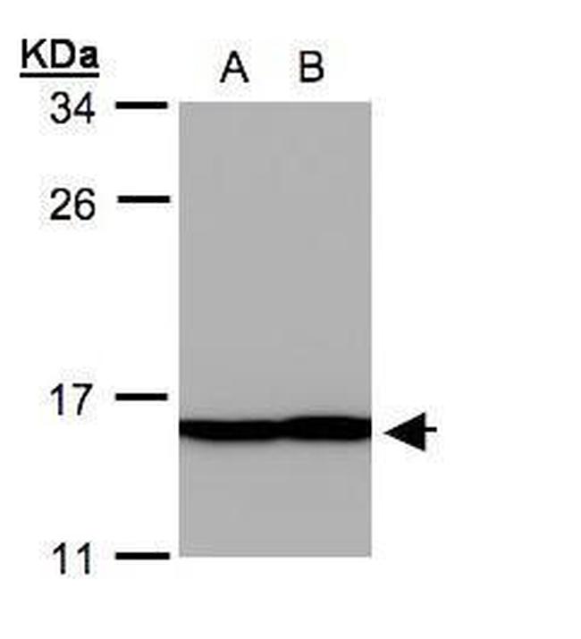 Profilin 2 Antibody in Western Blot (WB)