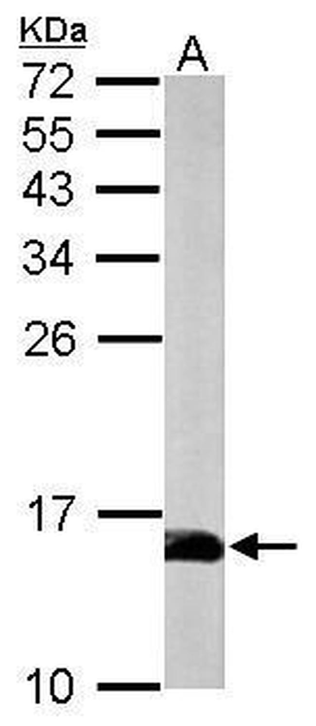 Profilin 2 Antibody in Western Blot (WB)