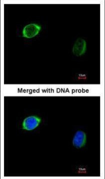 RAB2B Antibody in Immunocytochemistry (ICC/IF)