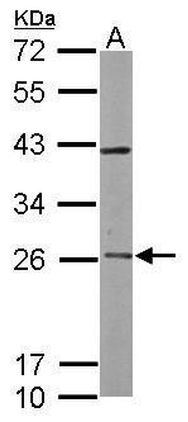 RAB3C Antibody in Western Blot (WB)