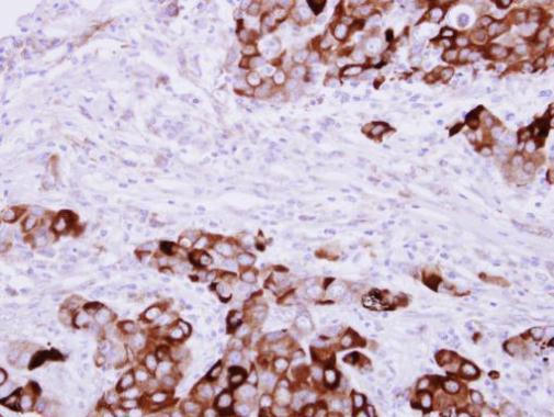 Fibrinogen gamma Antibody in Immunohistochemistry (Paraffin) (IHC (P))