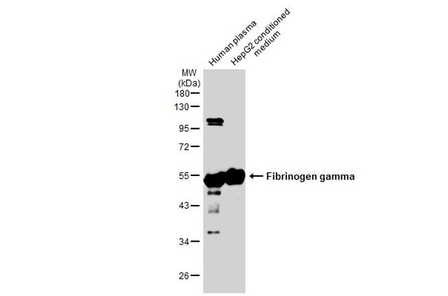 Fibrinogen gamma Antibody in Western Blot (WB)