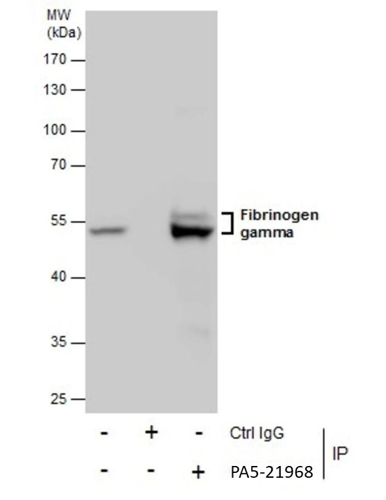 Fibrinogen gamma Antibody in Immunoprecipitation (IP)