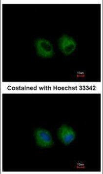 IL1R2 Antibody in Immunocytochemistry (ICC/IF)