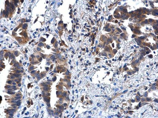 IL1R2 Antibody in Immunohistochemistry (Paraffin) (IHC (P))