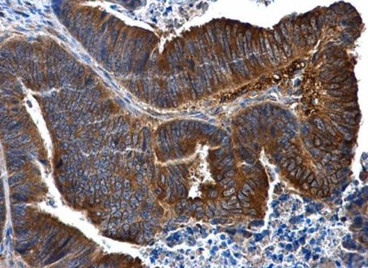 IL1R2 Antibody in Immunohistochemistry (Paraffin) (IHC (P))