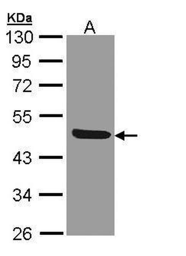 IL1R2 Antibody in Western Blot (WB)